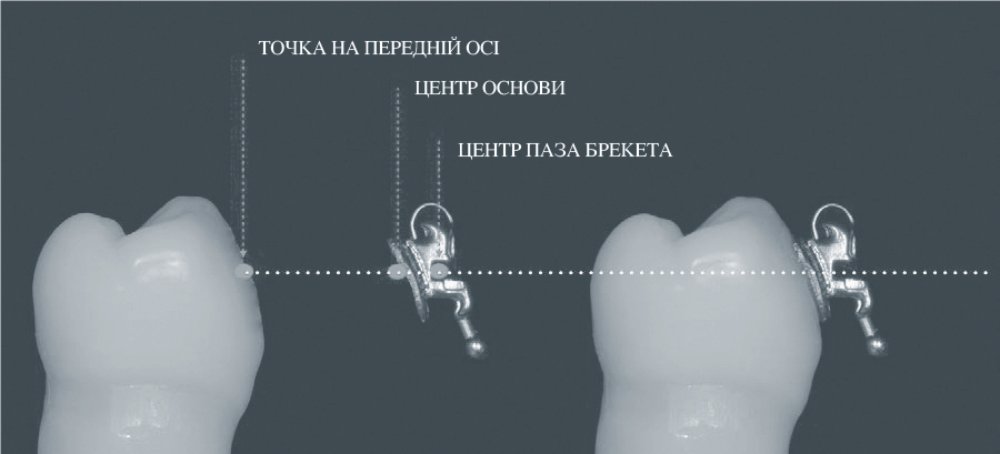 Ідеальне співвідношення між центром паза, центром основи брекета та точки прив’язки Ідеальне співвідношення між центром паза, центром основи брекета та точки прив’язки