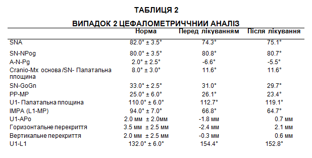 Таблиця 2. Цефалометричний аналіз