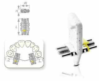 VECTOR 140, 160 Standard-Expans. Medium