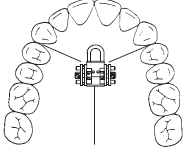 VECTOR 700, BIOGNATH