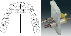 VECTOR 80, Standard-Expans. Medium